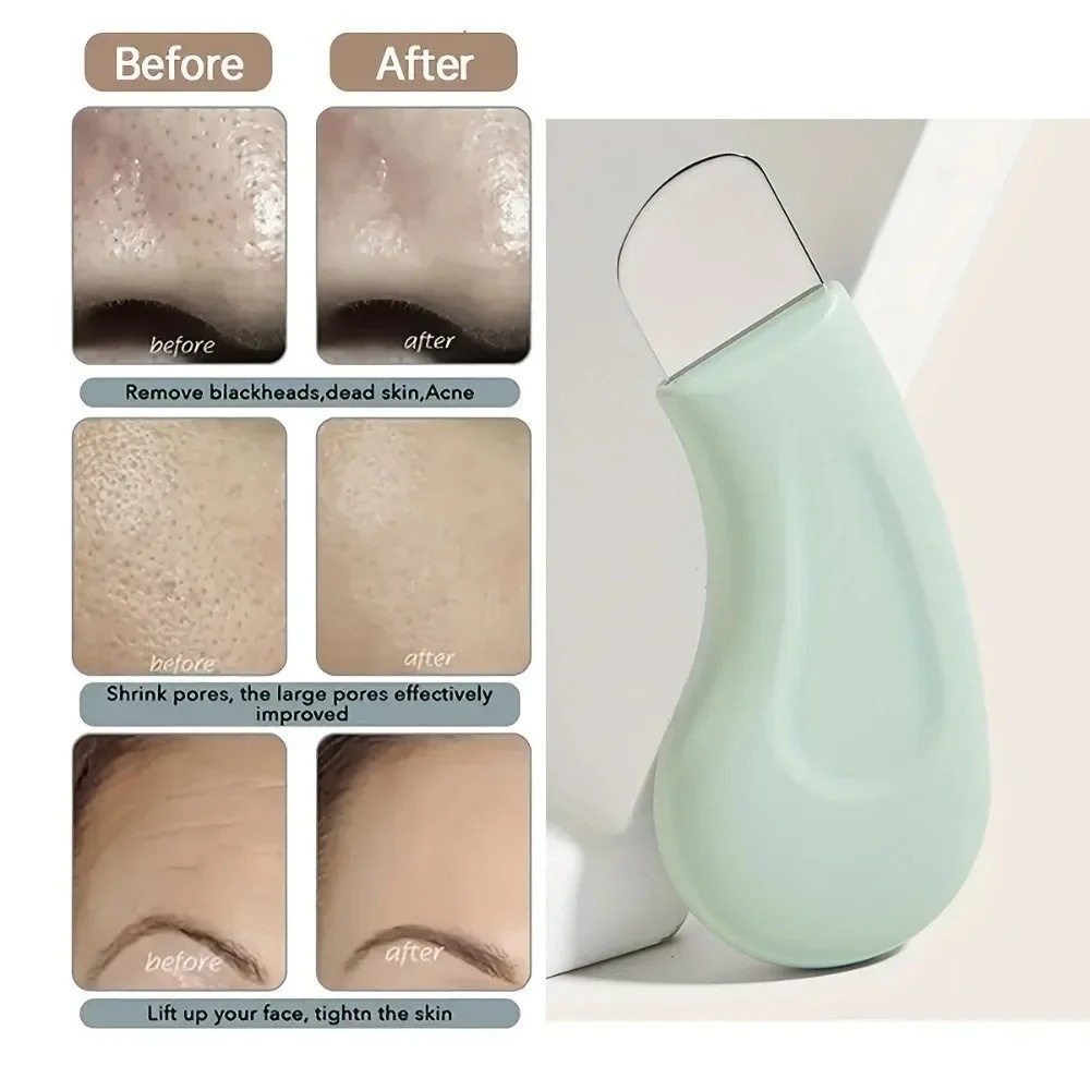 Alat Pembersih Komedo dan Whit - Skincare Routine ulasan dan harga